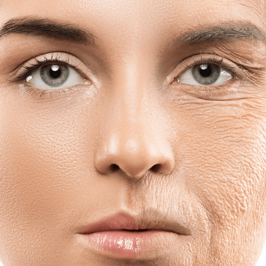 webinar huidklachten.